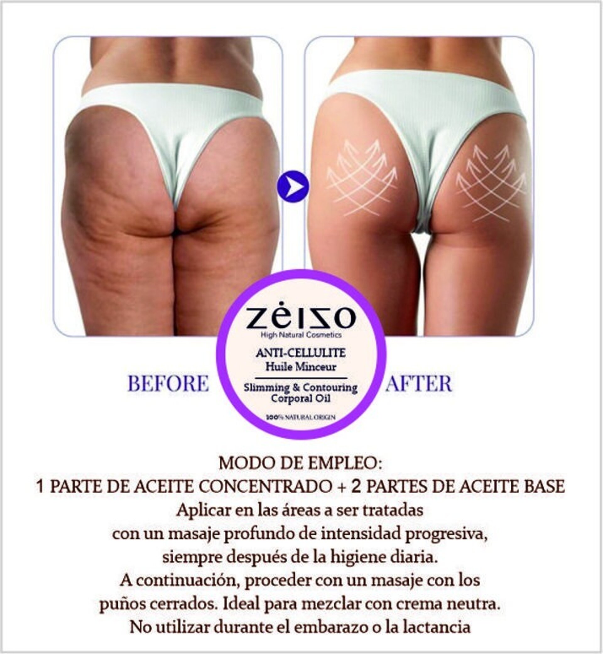 Aceite anti celulítico concentrado Zeizo 150 ml - 2